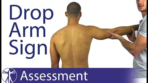 supraspinatus drop arm test|shoulder drop off sign meaning.